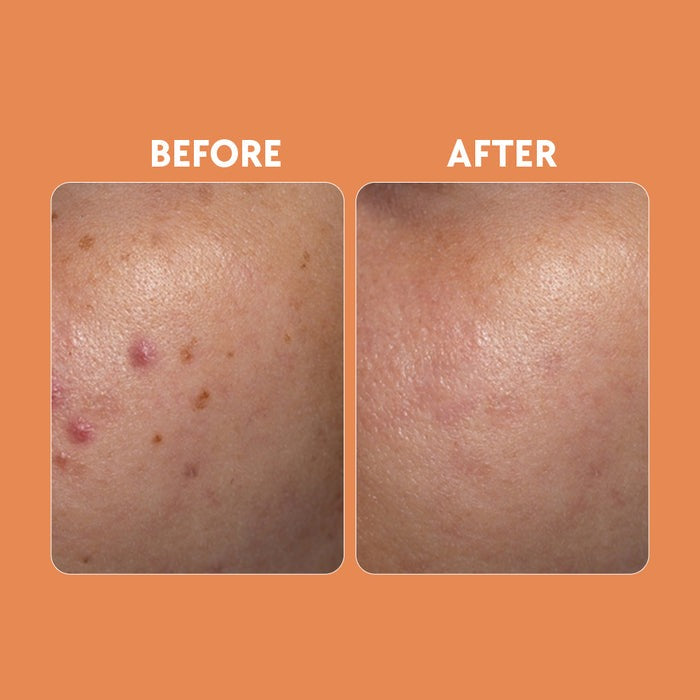 Posch Care Vitamin C Brightening Serum