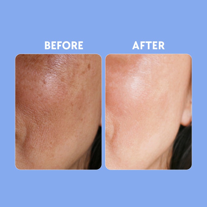 Posch Care Hyaluronic Acid Serum